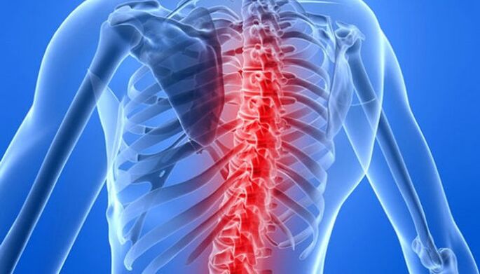 Les pathologies de la colonne vertébrale sont les causes les plus fréquentes de maux de dos au niveau des omoplates. 