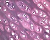 Joint au microscope