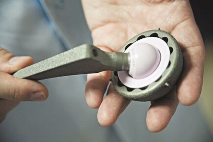 Chirurgie pour l'arthrose