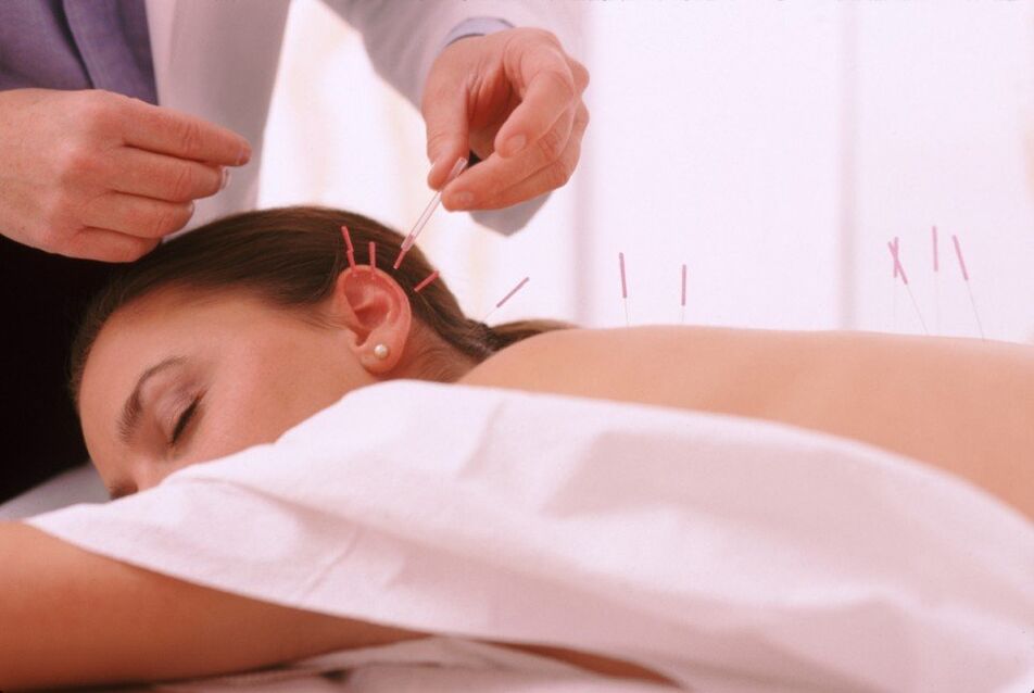 Acupuncture pour l'ostéochondrose cervicale.