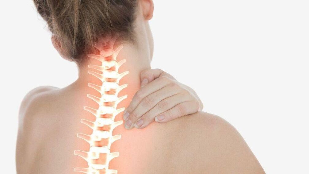 Avec l'ostéochondrose de la colonne cervicale, un syndrome radiculaire peut se développer.