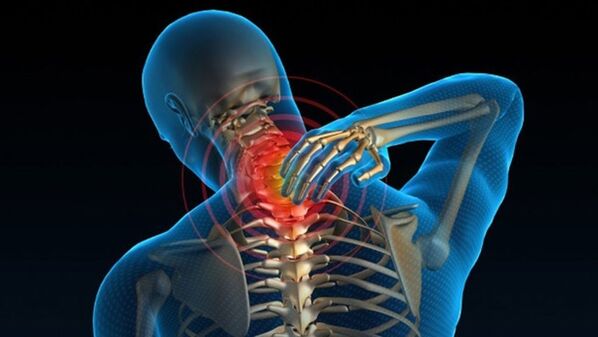 Une douleur en tournant le cou peut indiquer un syndrome d'ostéochondrose vertébrale cervicale.